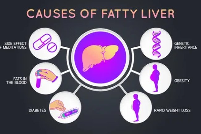5 Reasons to Consider Being at risk for developing liver Disease