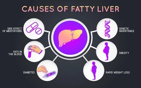 5 Reasons to Consider Being at risk for developing liver Disease