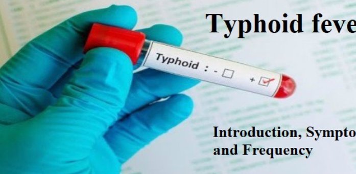 Typhoid Fever 